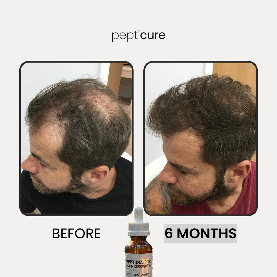 Pepticure™ Advanced Peptide Regrowth Formula