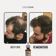 Pepticure™ Advanced Peptide Regrowth Formula