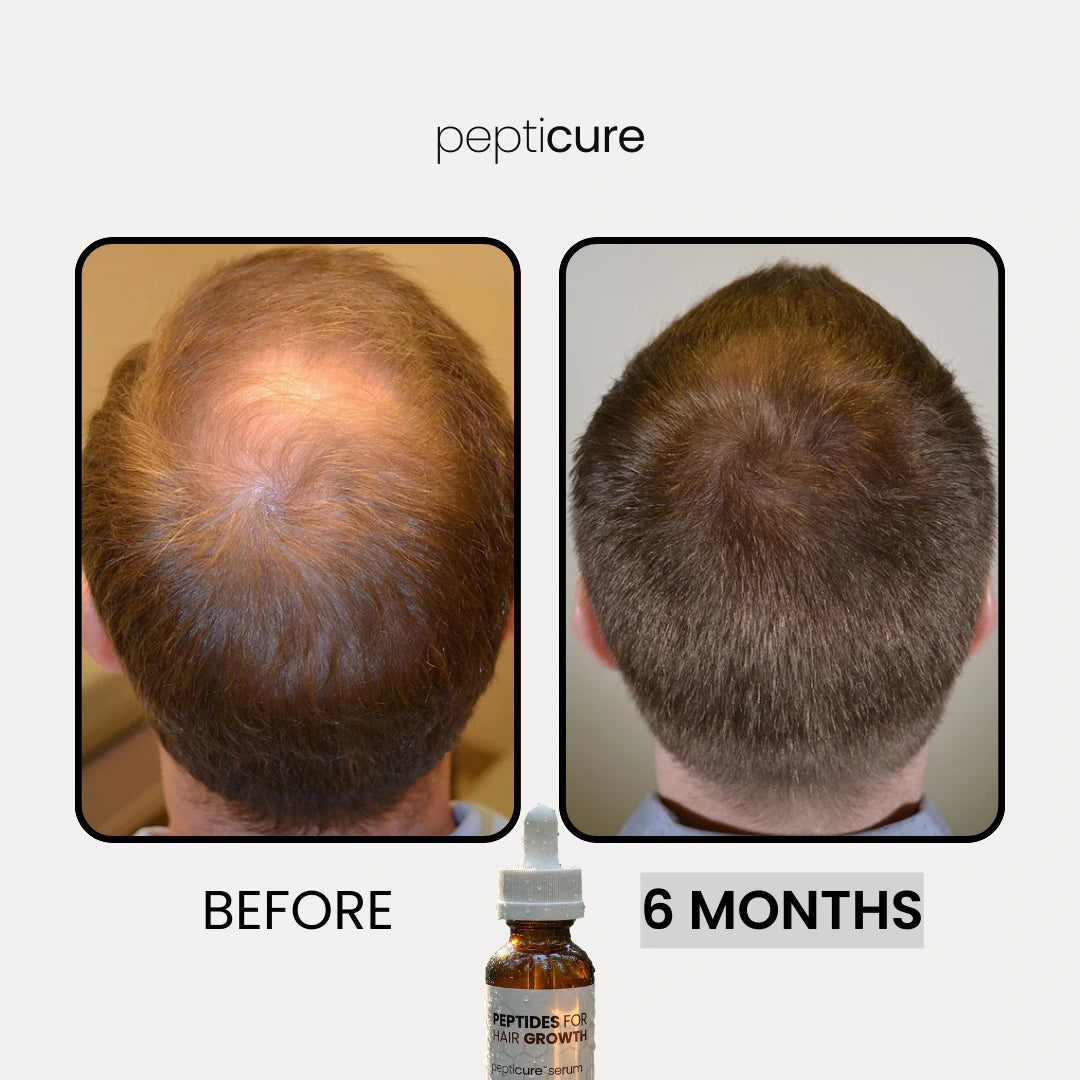 Pepticure™ Advanced Peptide Regrowth Formula