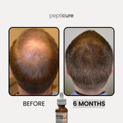 Pepticure™ Advanced Peptide Regrowth Formula