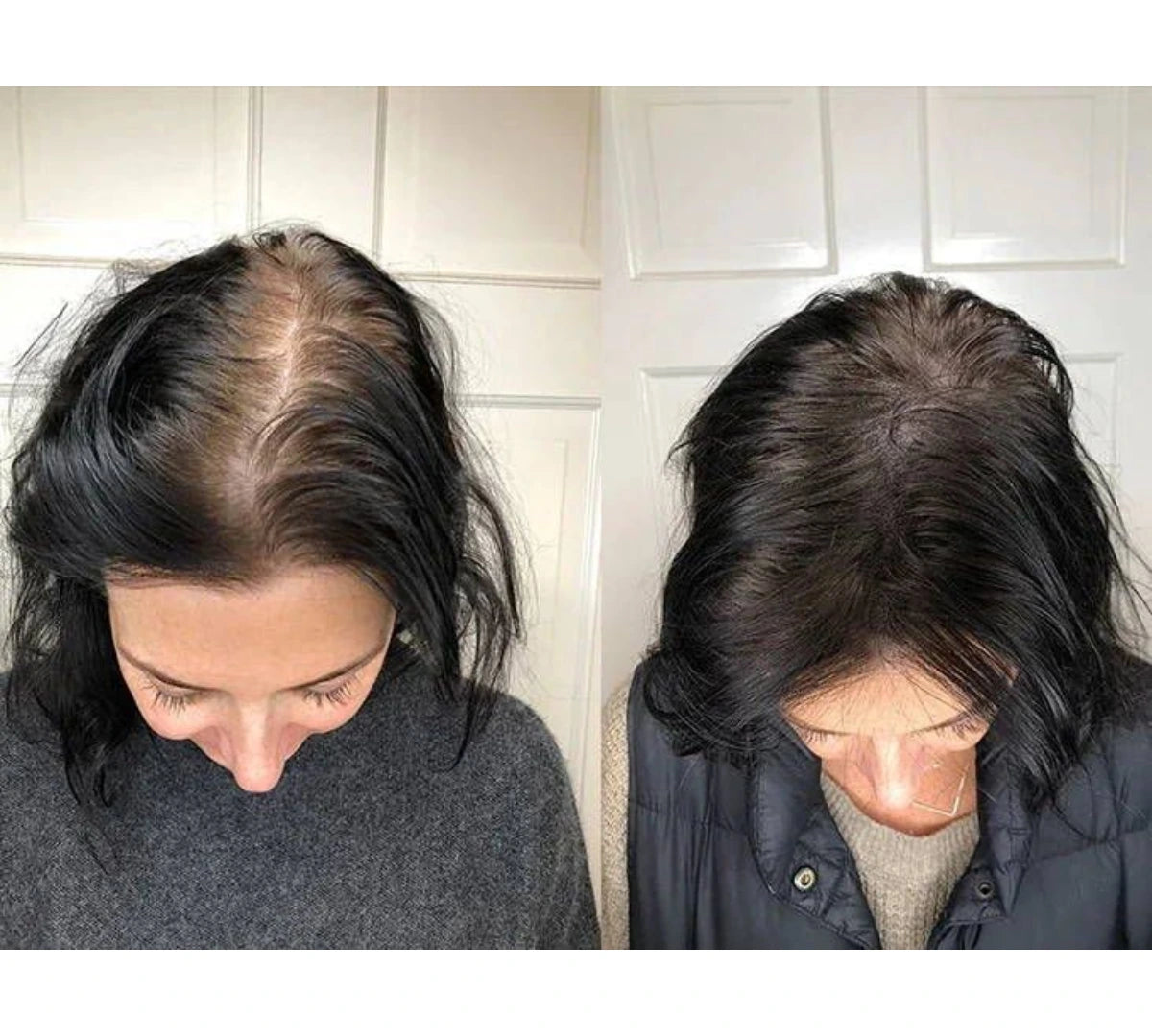 "My husband saw it before I did. I hadn't told him I was using anything."