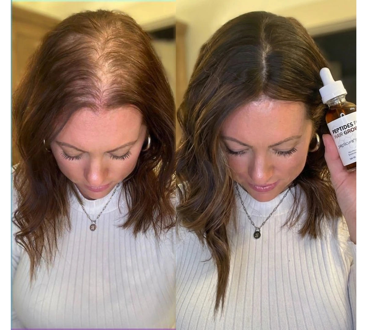 I've wasted $2,000 on hair products. This is the first one that actually did something.