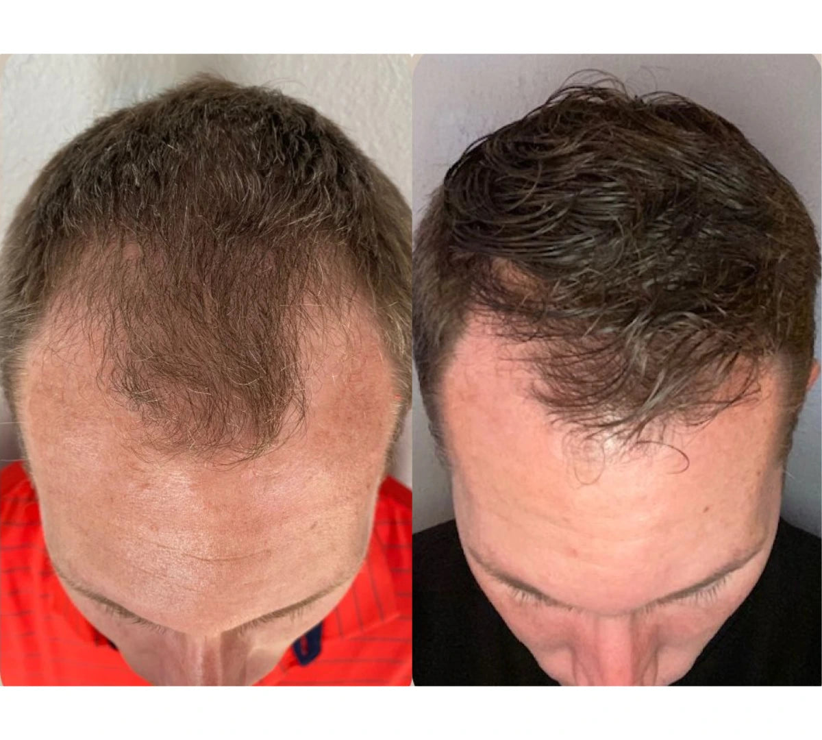 "By month 3, I stopped wearing hats to client meetings."